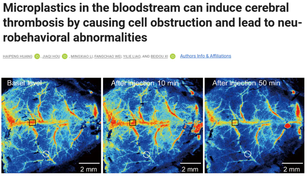 Microplastics Invade the Brain: How to Overcome Plastic Anxiety?